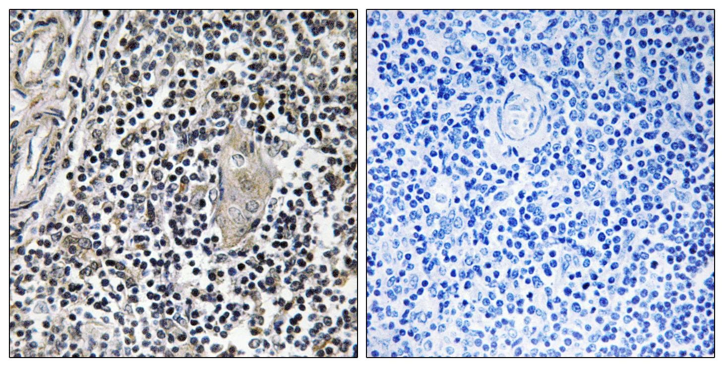 STMN1 / Stathmin / LAG Antibody (p15)