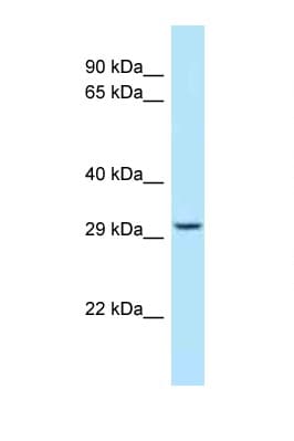 Polyclonal Rabbit anti-Human STOM / Stomatin Antibody (aa203-252, IHC, IF, WB)