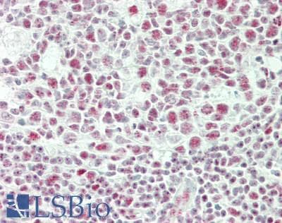 IHC-plus™ PELP1 Antibody (aa1000-1050)