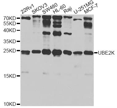 UBE2K / LIG Antibody