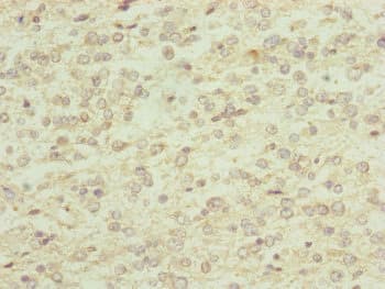 Polyclonal Rabbit anti-Human RNF13 Antibody (IHC, WB)
