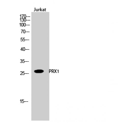 PRX-1 / PRRX1 Antibody (30-110 aa, Internal)