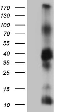 ITM2A Antibody (clone OTI2D5)