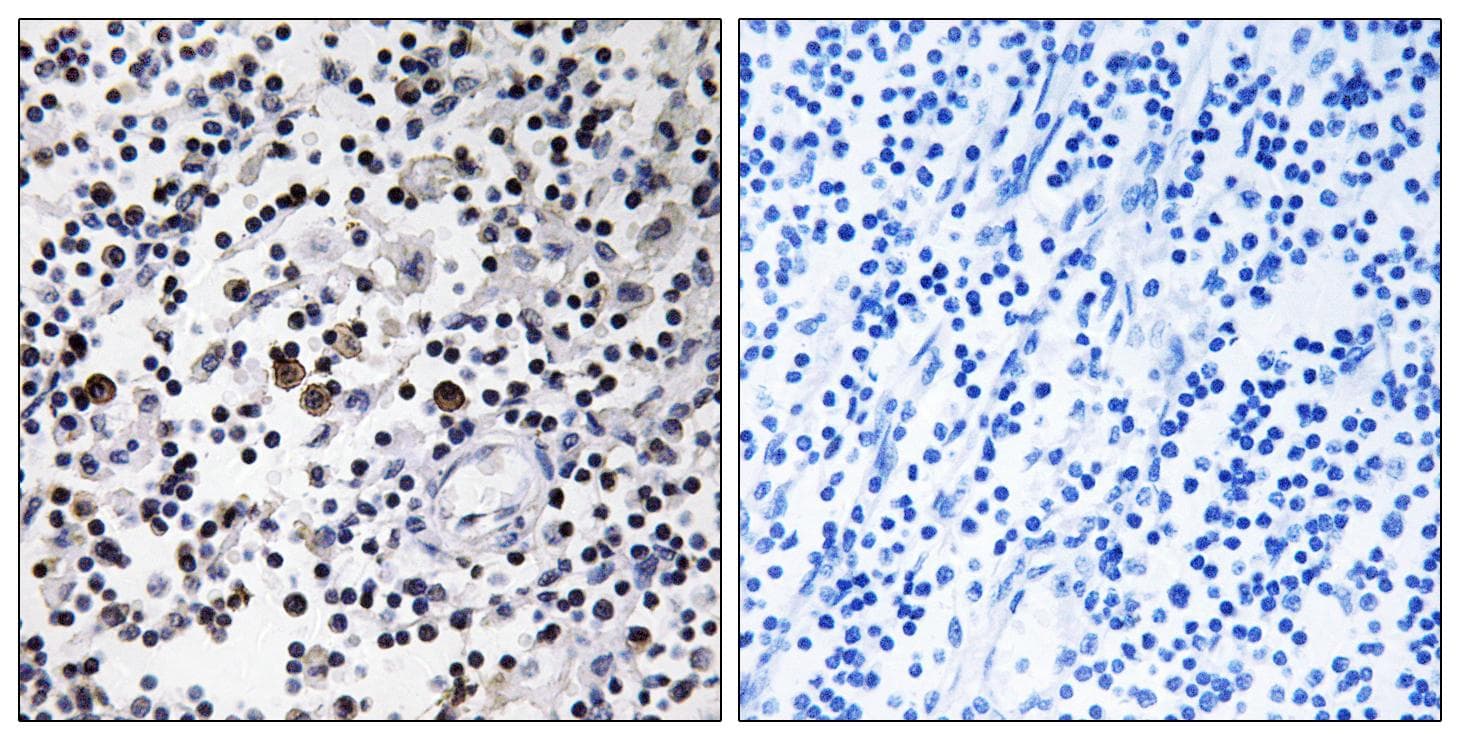 Polyclonal Rabbit anti-Human CD302 Antibody (IHC, WB)