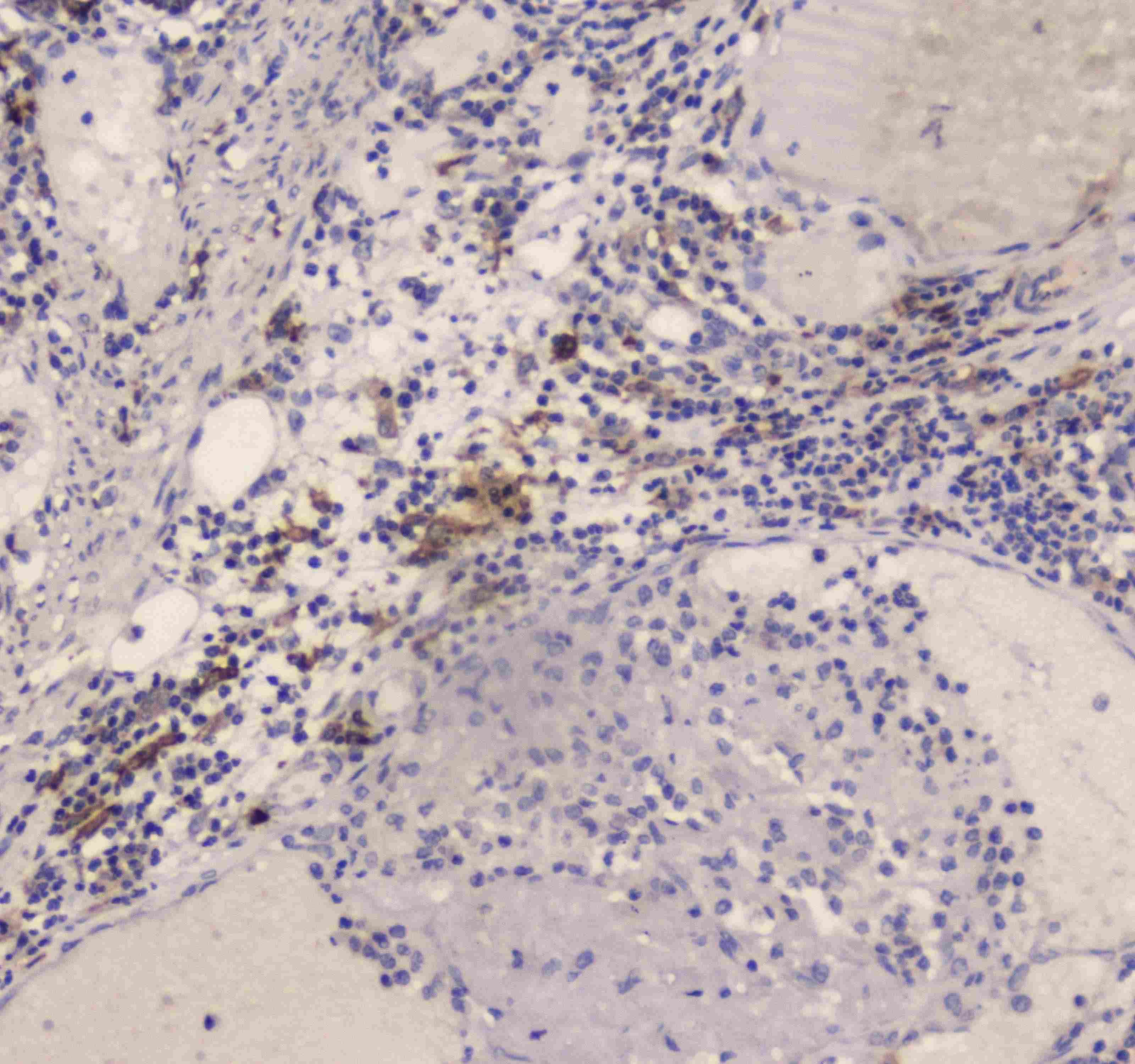 CD209 / DC-SIGN Antibody
