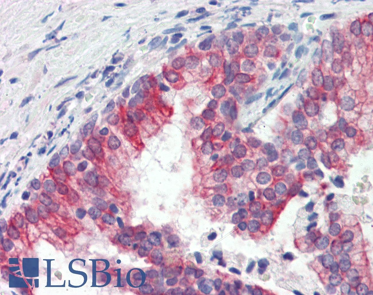 PathPlus™ Polyclonal Goat anti-Human ROR1 Antibody (IHC)