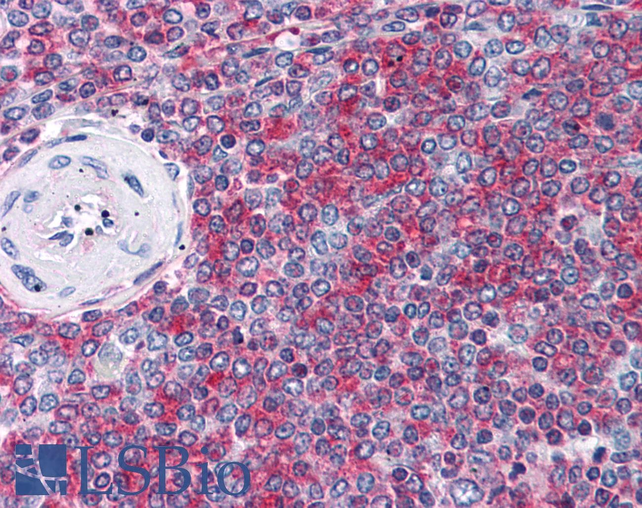 IHC-plus™ Polyclonal Rabbit anti-Human ARL15 Antibody (IHC, WB)