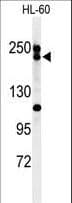 Polyclonal Rabbit anti-Human BLM Antibody (aa1054-1082, WB)