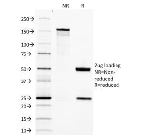 Monoclonal Mouse anti-Human Adipokines / Adiponectin Antibody (clone ADPN/1370, Ready-to-Use, IHC)