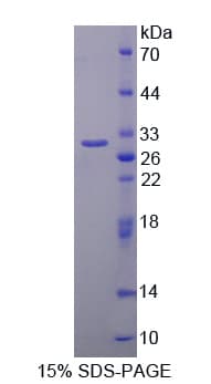 Human SRPK2 Protein (Recombinant His-T7)