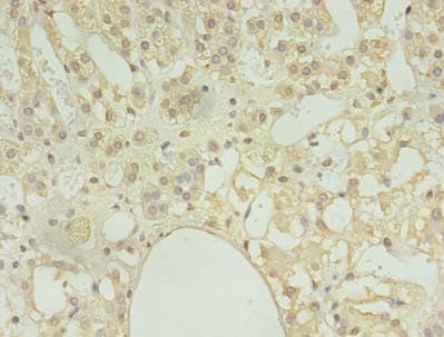 COPB1 / Beta-COP Antibody