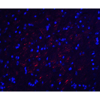 PathPlus™ OCLN / Occludin Antibody
