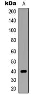 IHC-plus™ Polyclonal Rabbit anti-Human SIAH2 Antibody (C-Terminus, IHC, IF, WB)