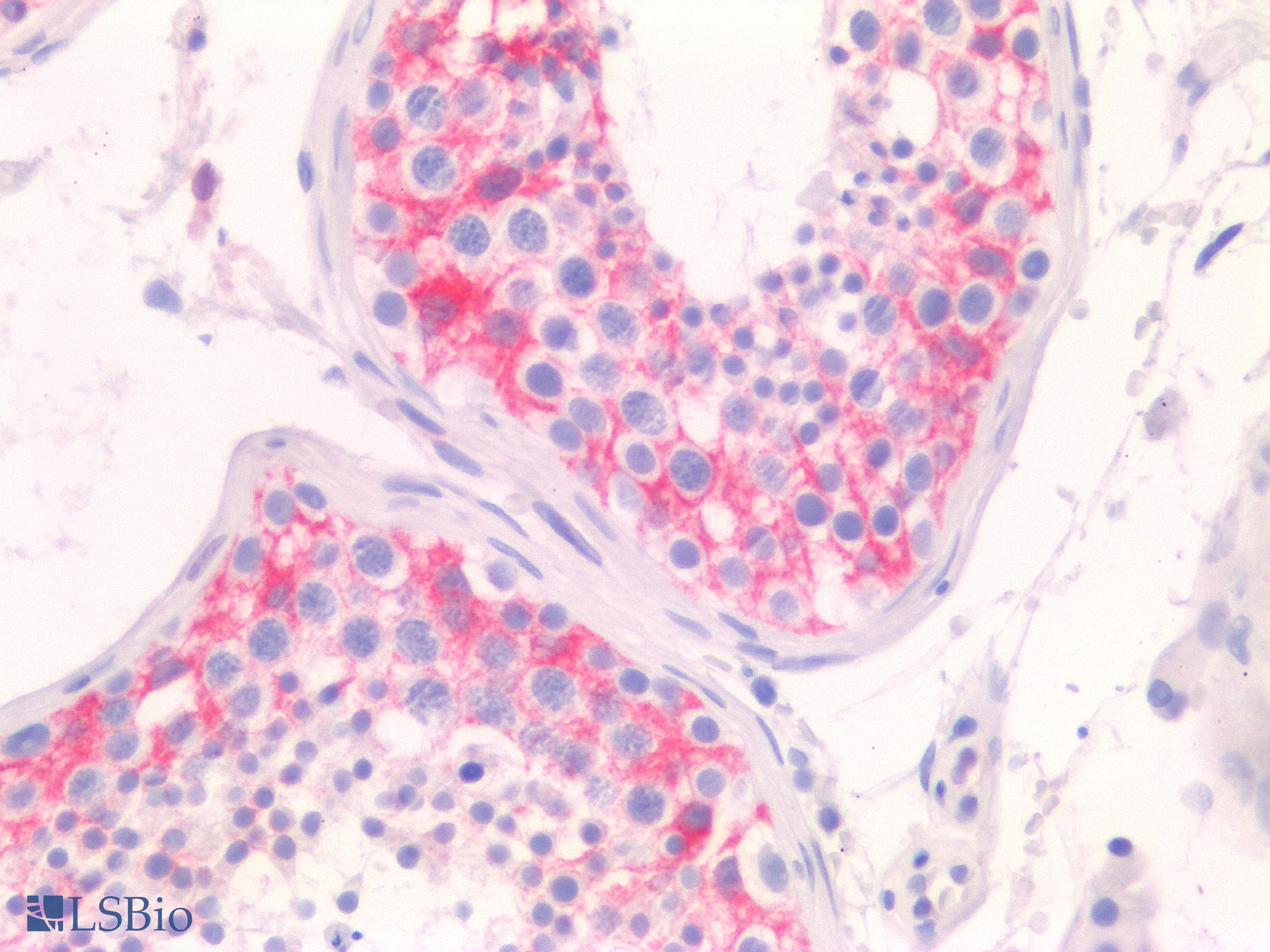 PathPlus™ FSCN1 / Fascin Antibody