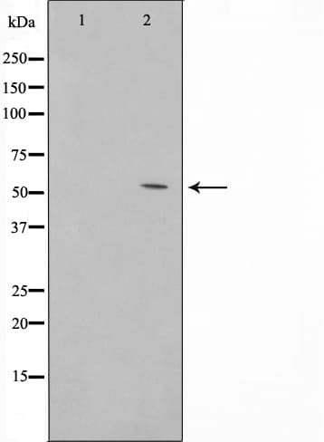 Polyclonal Rabbit anti-Human TINF2 Antibody (IF, WB)