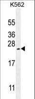 VEGFA / VEGF Antibody (aa140-168)