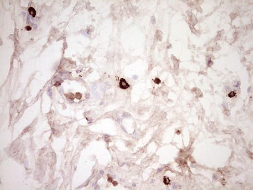 Monoclonal Mouse anti-Human CLOCK Antibody (clone OTI2H7, aa1-285, IHC, WB)