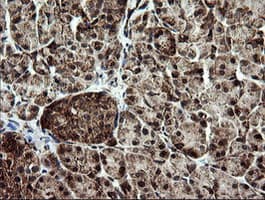 NDUFB9 Antibody (clone OTI3A1)