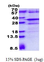 Human RSG1 Protein (Recombinant His)