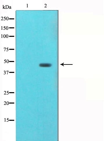 AGER / RAGE Antibody