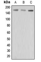 ABCC3 / MRP3 Antibody (Internal)