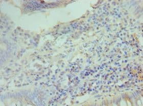 CCND2 / Cyclin D2 Antibody (aa1-289)