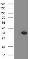IHC-plus™ MYD88 Antibody (clone 1B4)