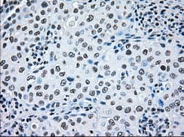 BRAF / B-Raf Antibody (clone OTI4C11)