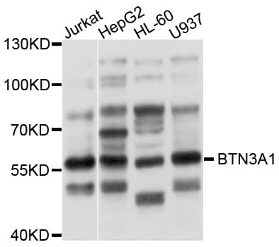 IHC-plus™ BTN3A1 / CD277 Antibody