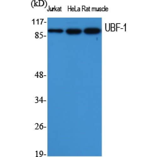 UBTF / UBF Antibody (470-550 aa, Internal)