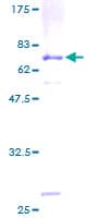 Human CTSD / Cathepsin D Protein (Recombinant GST)