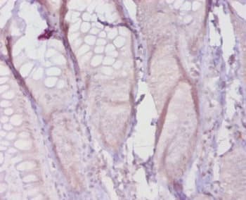 Polyclonal Rabbit anti-Rat COL1A1 / Collagen I Alpha 1 Antibody (IHC)