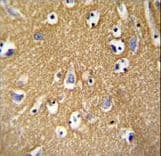 Polyclonal Rabbit anti-Human BCAN / Brevican Antibody (aa715-741, IHC, WB)