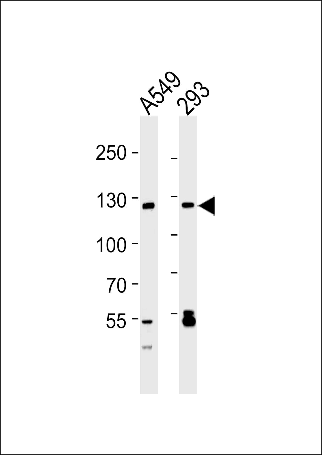 SIRT1 / Sirtuin 1 Antibody (aa1-180, clone 1089CT5.3.1)