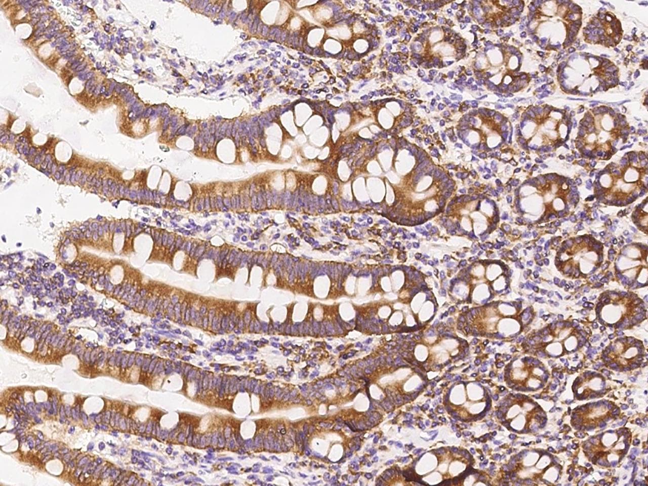 FARSA Antibody