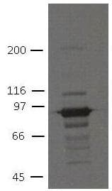 Monoclonal Mouse anti-Human PKP3 / Plakophilin 3 Antibody (clone 7F6, IHC, WB)