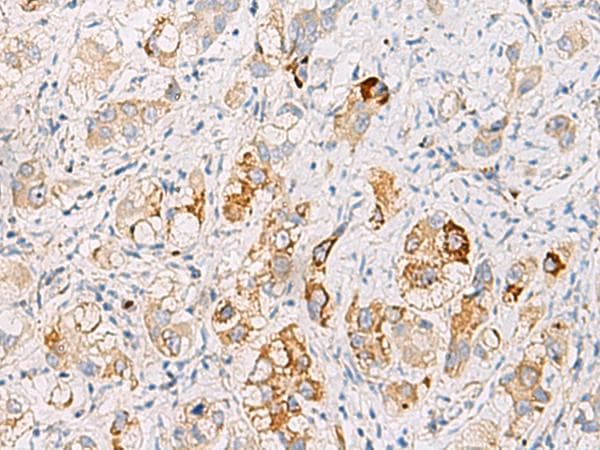 DHRS2 / HEP27 Antibody