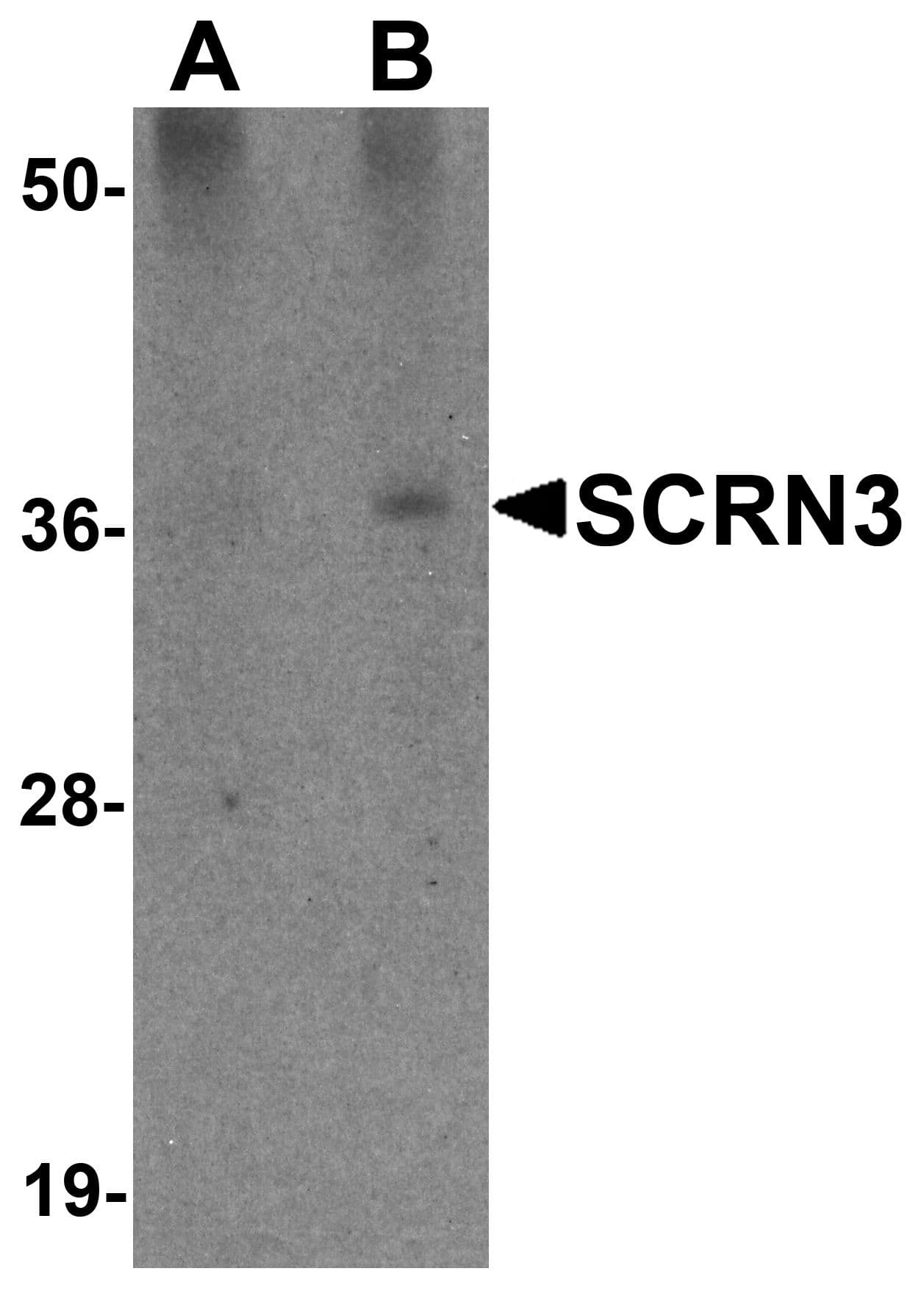 IHC-plus™ SCRN3 Antibody