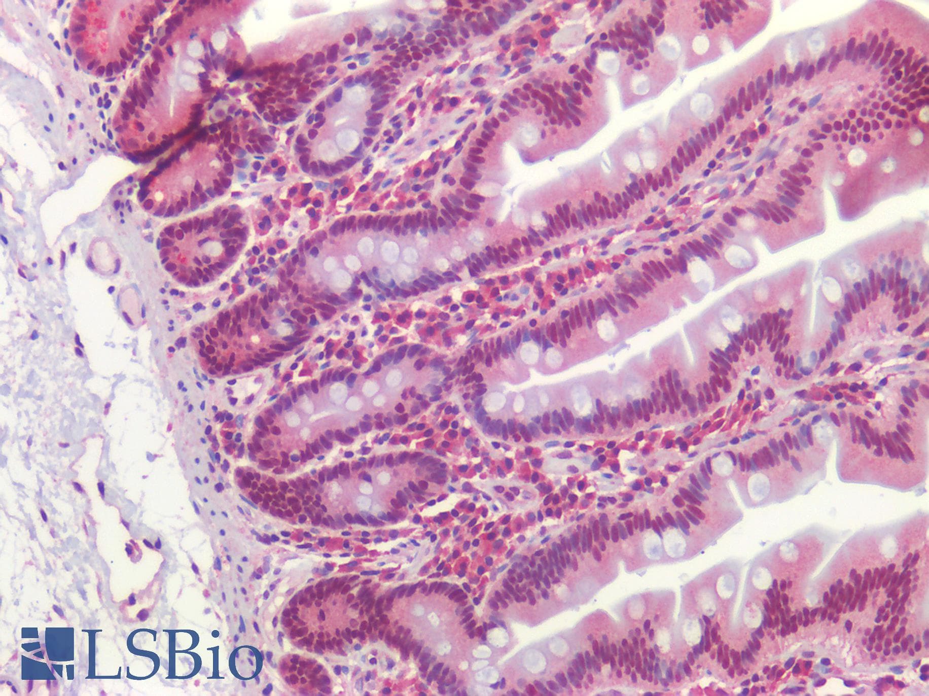 IHC-plus™ TIRC7 / TCIRG1 Antibody (C-Terminus)