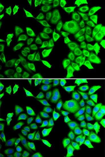 Polyclonal Rabbit anti-Human THADA Antibody (IHC, IF, WB)