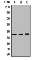 Polyclonal Rabbit anti-Human POMT1 Antibody (WB)