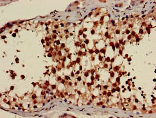 PRKAG1 / AMPK Gamma 1 Antibody