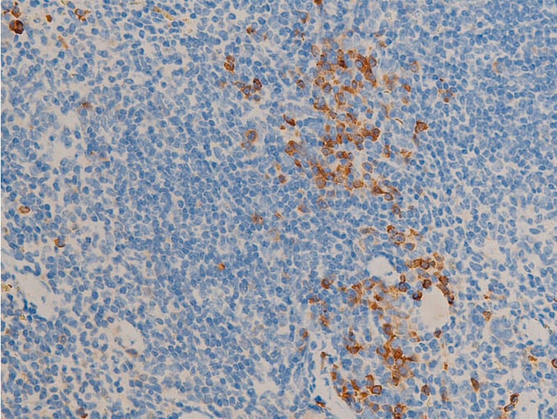 NR3C1/Glucocorticoid Receptor Antibody (phospho-Ser211)