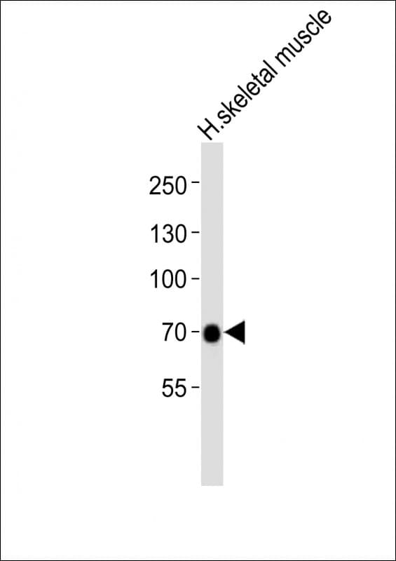 GABRQ / THETA Antibody (aa451-485)