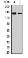 Polyclonal Rabbit anti-Human DIAPH3 / MDIA2 Antibody (WB)
