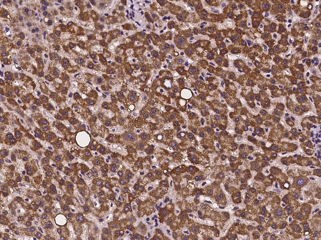 CMC1 Antibody