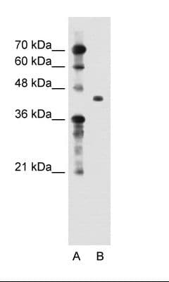 TGFBI Antibody (aa601-650)