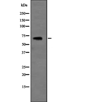 SLC6A3 / Dopamine Transporter Antibody