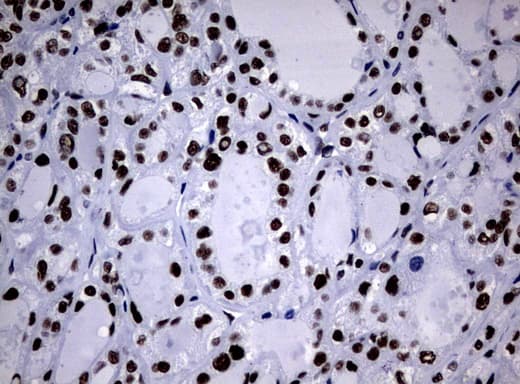 NBN / Nibrin Antibody (aa183-460, clone UMAB100, Carrier-free)
