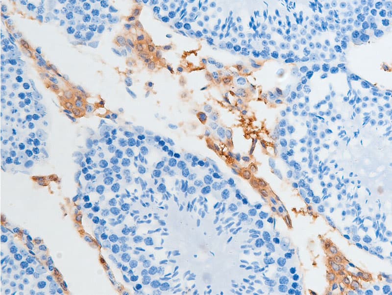 CHEK2 / CHK2 Antibody (phospho-Ser516)